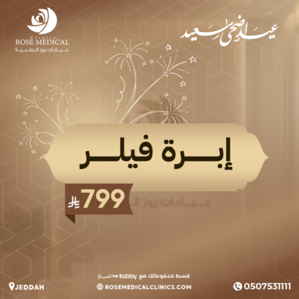 ابرة فيلر