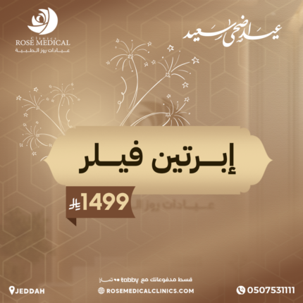 ابرتين فيلر